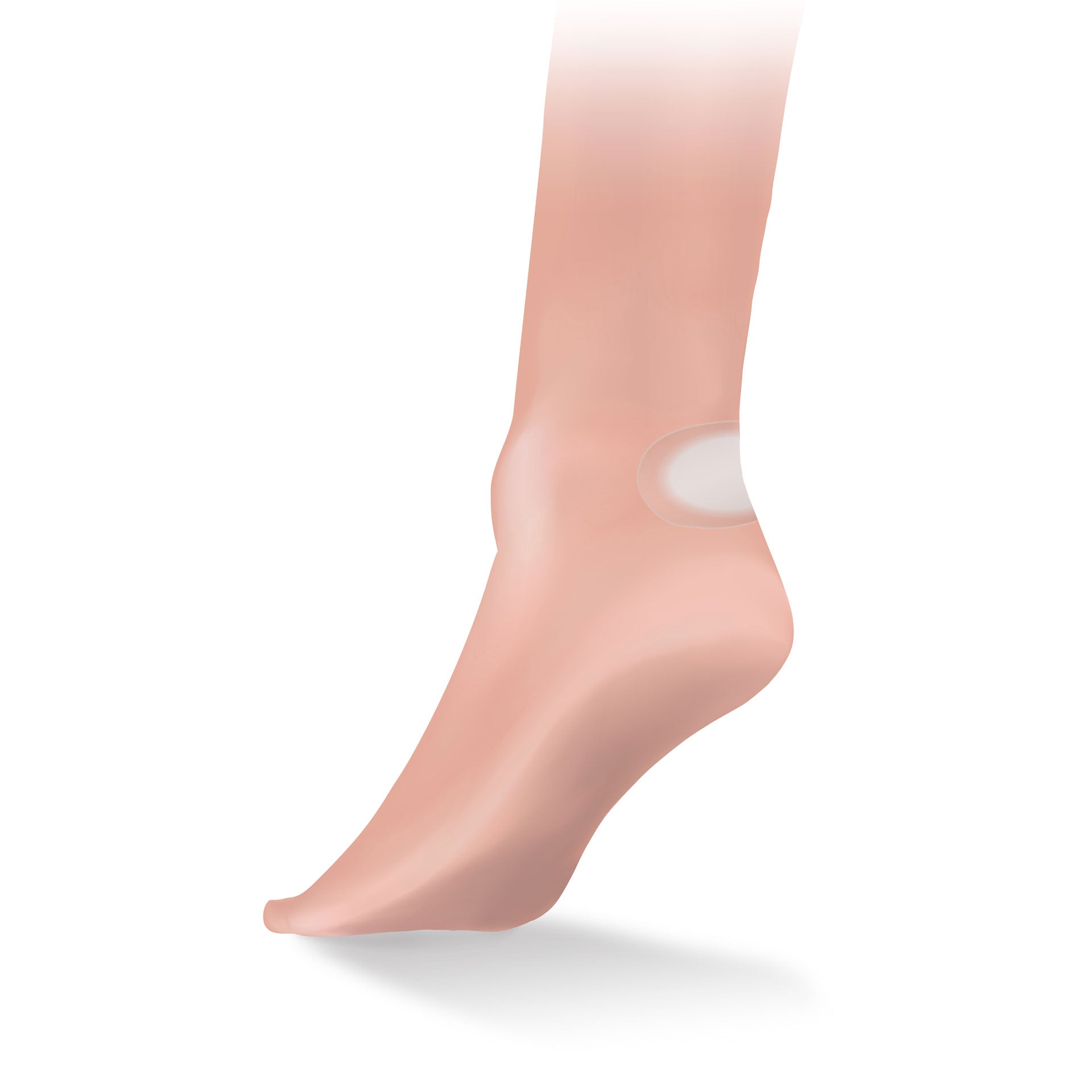 Life Systems Sterile Blister Plasters